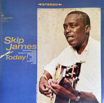 James, Skip - Today