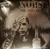 Noise - Scars We Hide